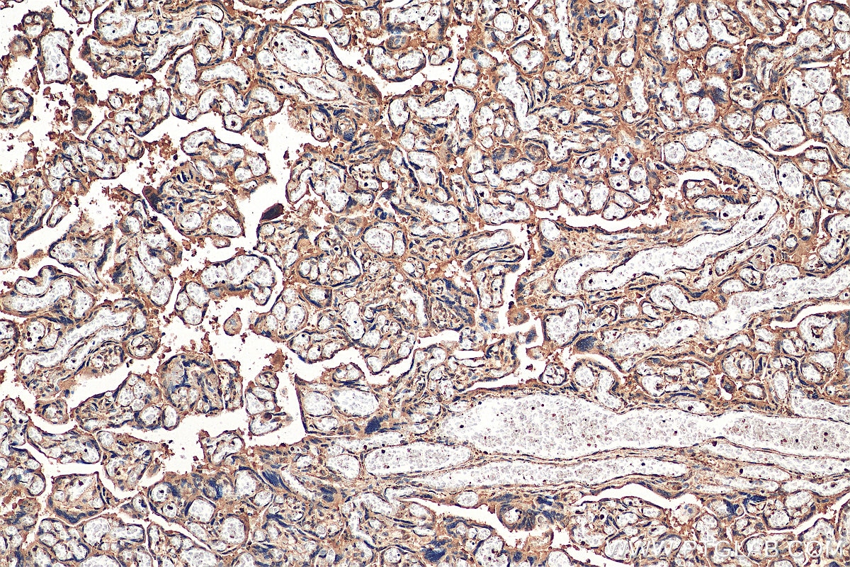 Immunohistochemistry (IHC) staining of human placenta tissue using PARP11 Polyclonal antibody (16692-1-AP)