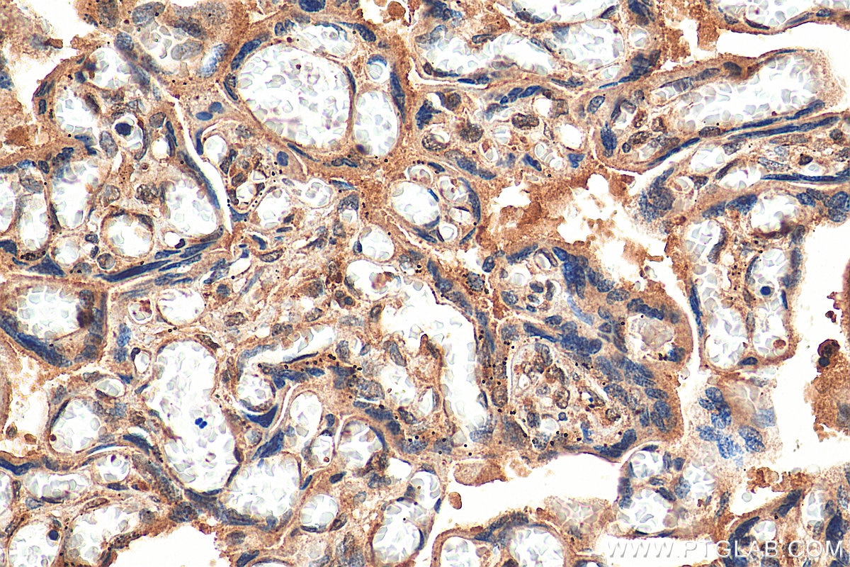 Immunohistochemistry (IHC) staining of human placenta tissue using PARP11 Polyclonal antibody (16692-1-AP)