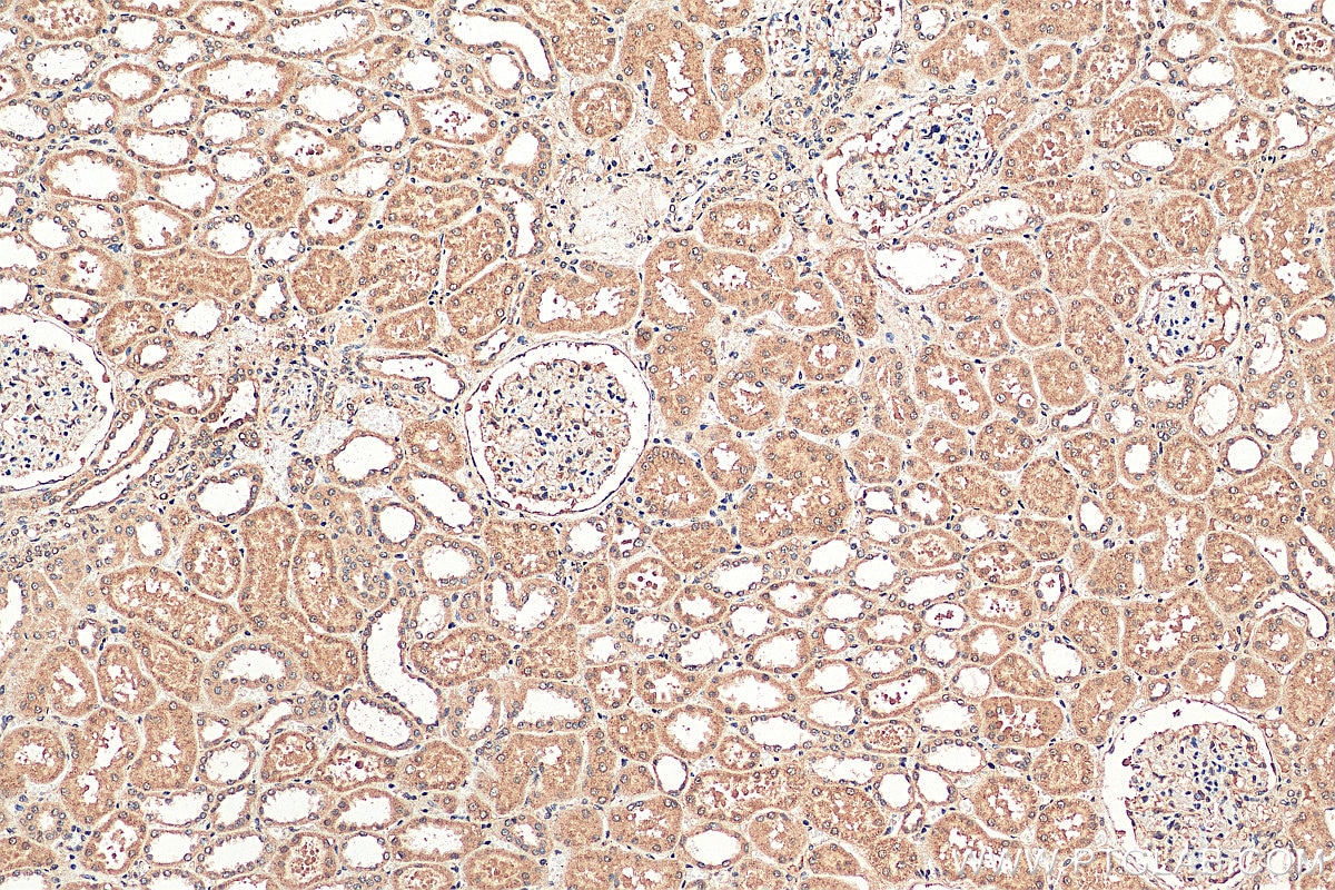 Immunohistochemistry (IHC) staining of human kidney tissue using PARP11 Polyclonal antibody (16692-1-AP)