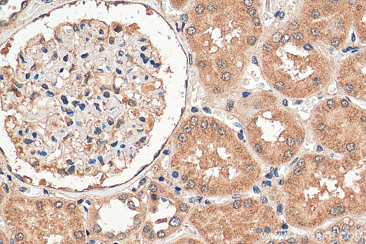 Immunohistochemistry (IHC) staining of human kidney tissue using PARP11 Polyclonal antibody (16692-1-AP)