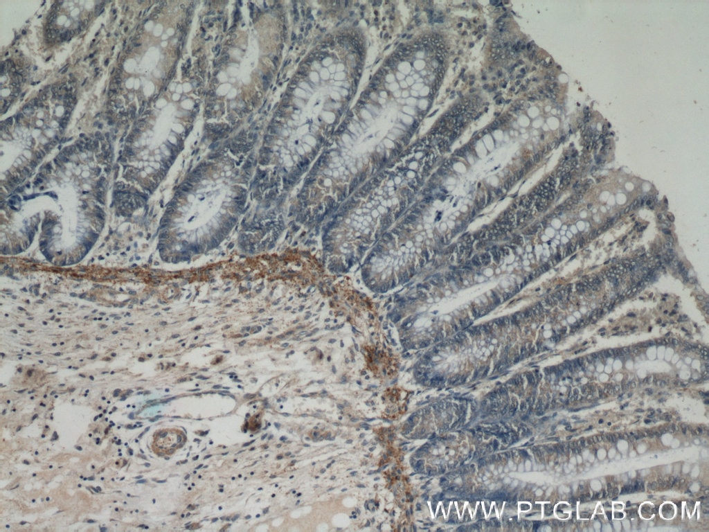 Immunohistochemistry (IHC) staining of human colon tissue using PARP11 Polyclonal antibody (16692-1-AP)