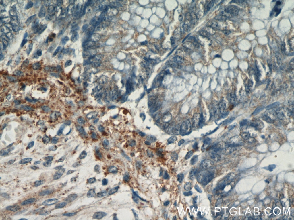Immunohistochemistry (IHC) staining of human colon tissue using PARP11 Polyclonal antibody (16692-1-AP)