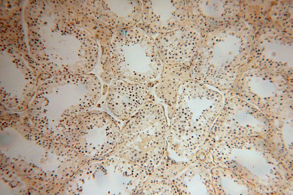 Immunohistochemistry (IHC) staining of human testis tissue using PARP11 Polyclonal antibody (16692-1-AP)