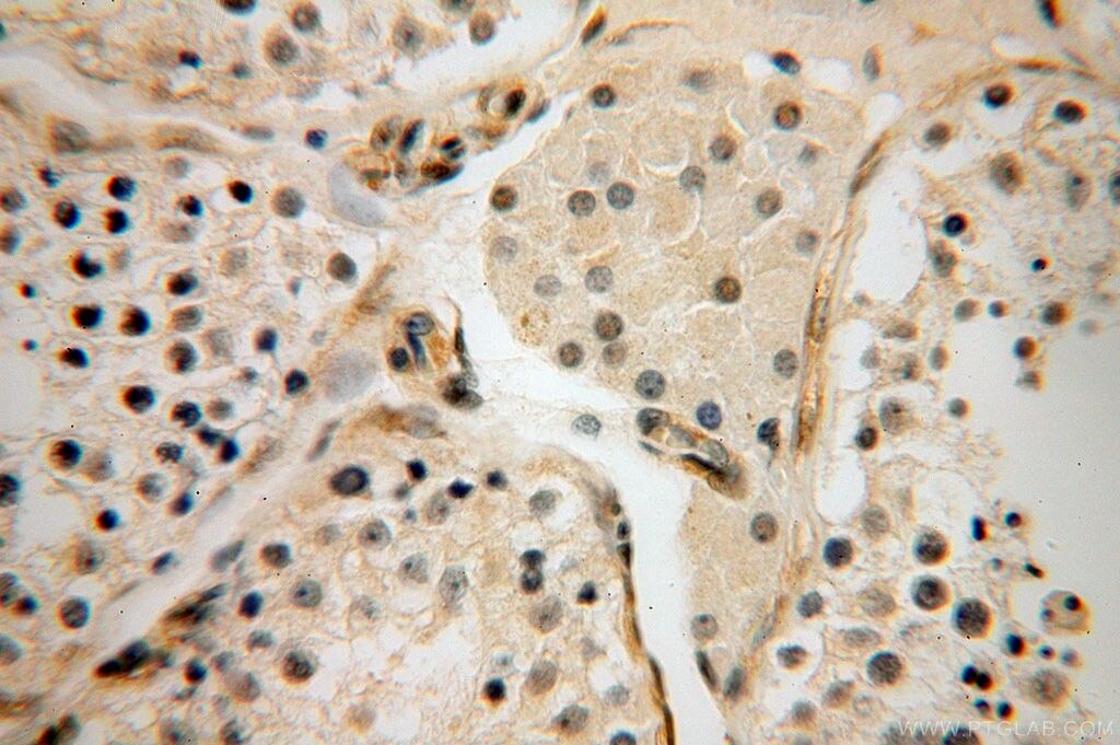 IHC staining of human testis using 16692-1-AP