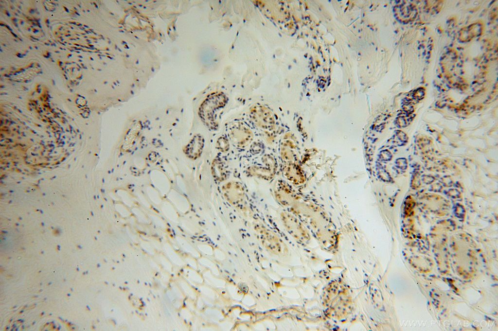 Immunohistochemistry (IHC) staining of human skin tissue using PARP11 Polyclonal antibody (16692-1-AP)