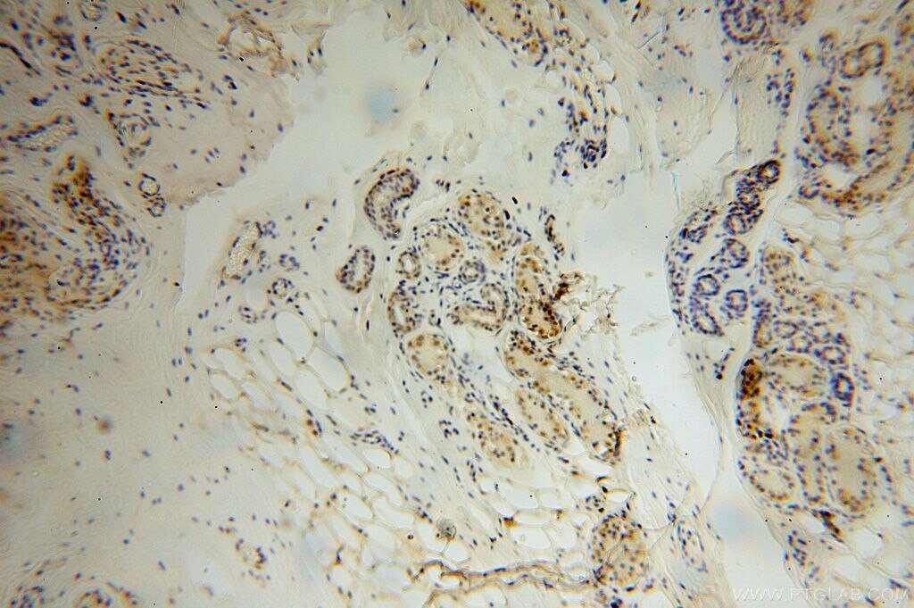 Immunohistochemistry (IHC) staining of human skin tissue using PARP11 Polyclonal antibody (16692-1-AP)