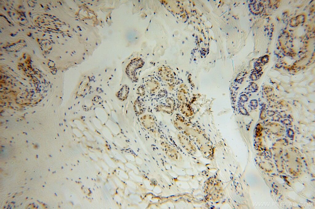 IHC staining of human skin using 16692-1-AP