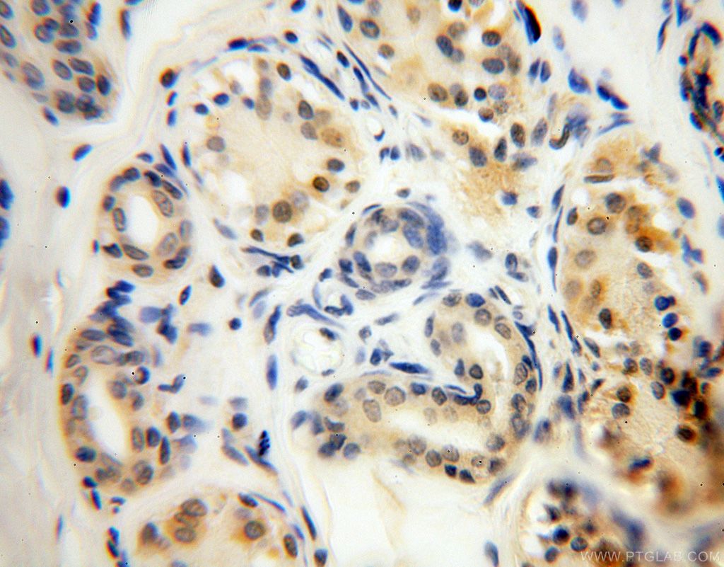 Immunohistochemistry (IHC) staining of human skin tissue using PARP11 Polyclonal antibody (16692-1-AP)