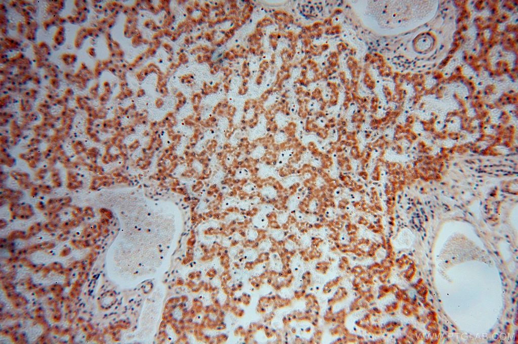 Immunohistochemistry (IHC) staining of human liver tissue using PARP11 Polyclonal antibody (16692-1-AP)