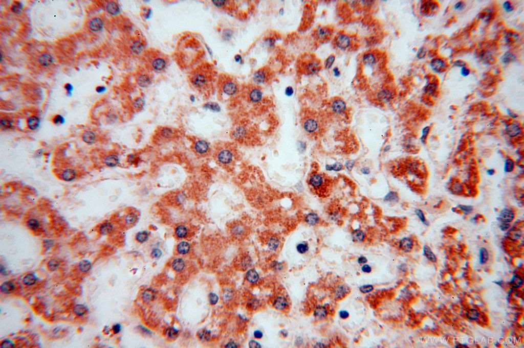 Immunohistochemistry (IHC) staining of human liver tissue using PARP11 Polyclonal antibody (16692-1-AP)