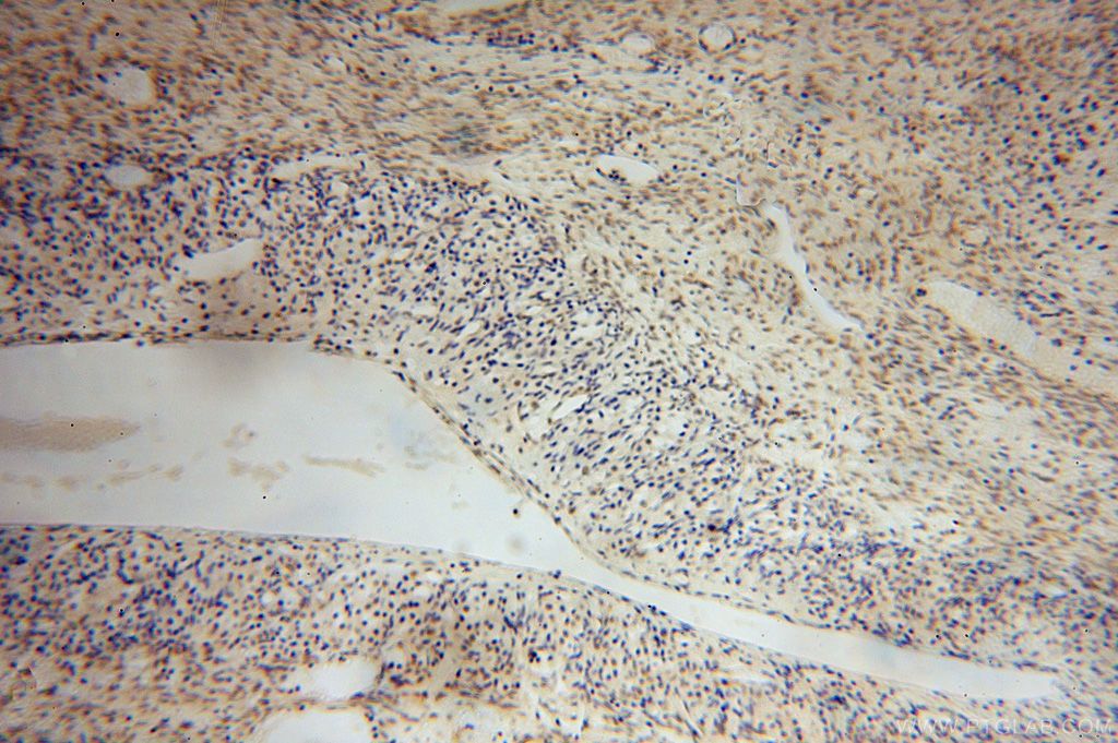 Immunohistochemistry (IHC) staining of human ovary tissue using PARP11 Polyclonal antibody (16692-1-AP)