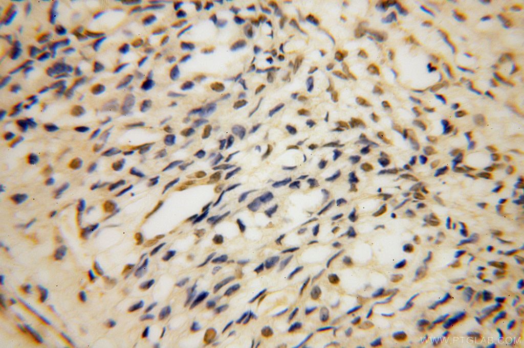 Immunohistochemistry (IHC) staining of human ovary tissue using PARP11 Polyclonal antibody (16692-1-AP)