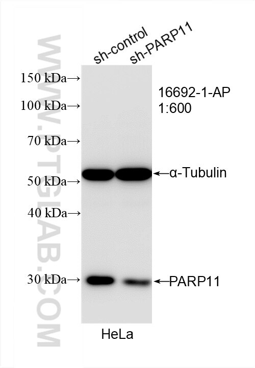 Western Blot (WB) analysis of HeLa cells using PARP11 Polyclonal antibody (16692-1-AP)