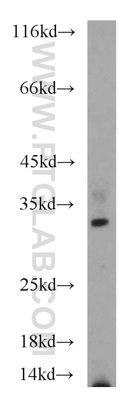 Western Blot (WB) analysis of PC-3 cells using PARP11 Polyclonal antibody (16692-1-AP)