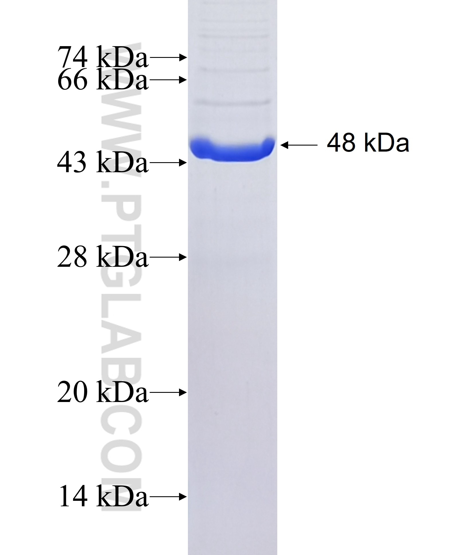PARP12 fusion protein Ag38760 SDS-PAGE PARP12 fusion protein Ag38760 SDS-PAGE