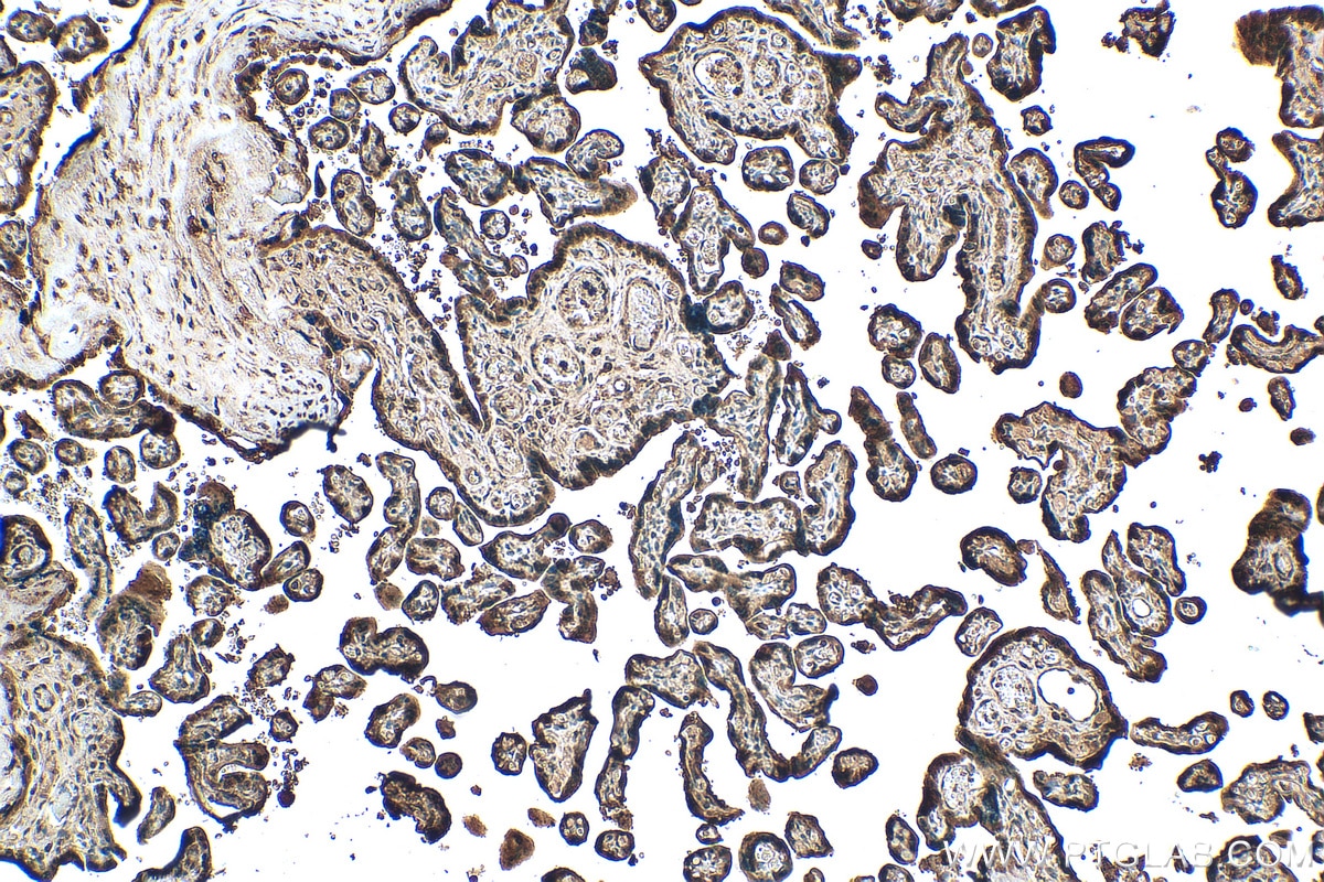 Immunohistochemistry (IHC) staining of human placenta tissue using PARP14 Polyclonal antibody (30127-1-AP)