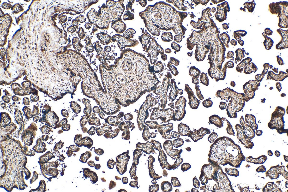 IHC staining of human placenta using 30127-1-AP