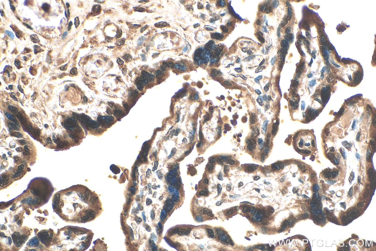 Immunohistochemistry (IHC) staining of human placenta tissue using PARP14 Polyclonal antibody (30127-1-AP)