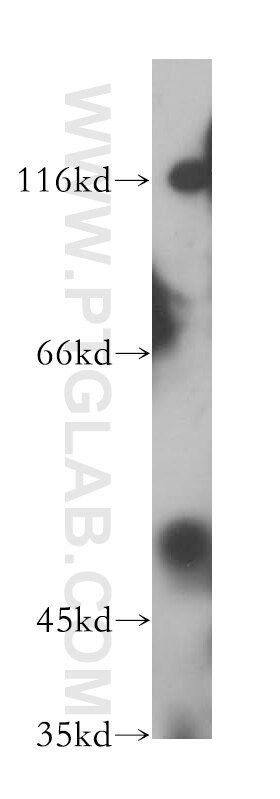 Western Blot (WB) analysis of Raji cells using PARP15 Polyclonal antibody (18126-1-AP)