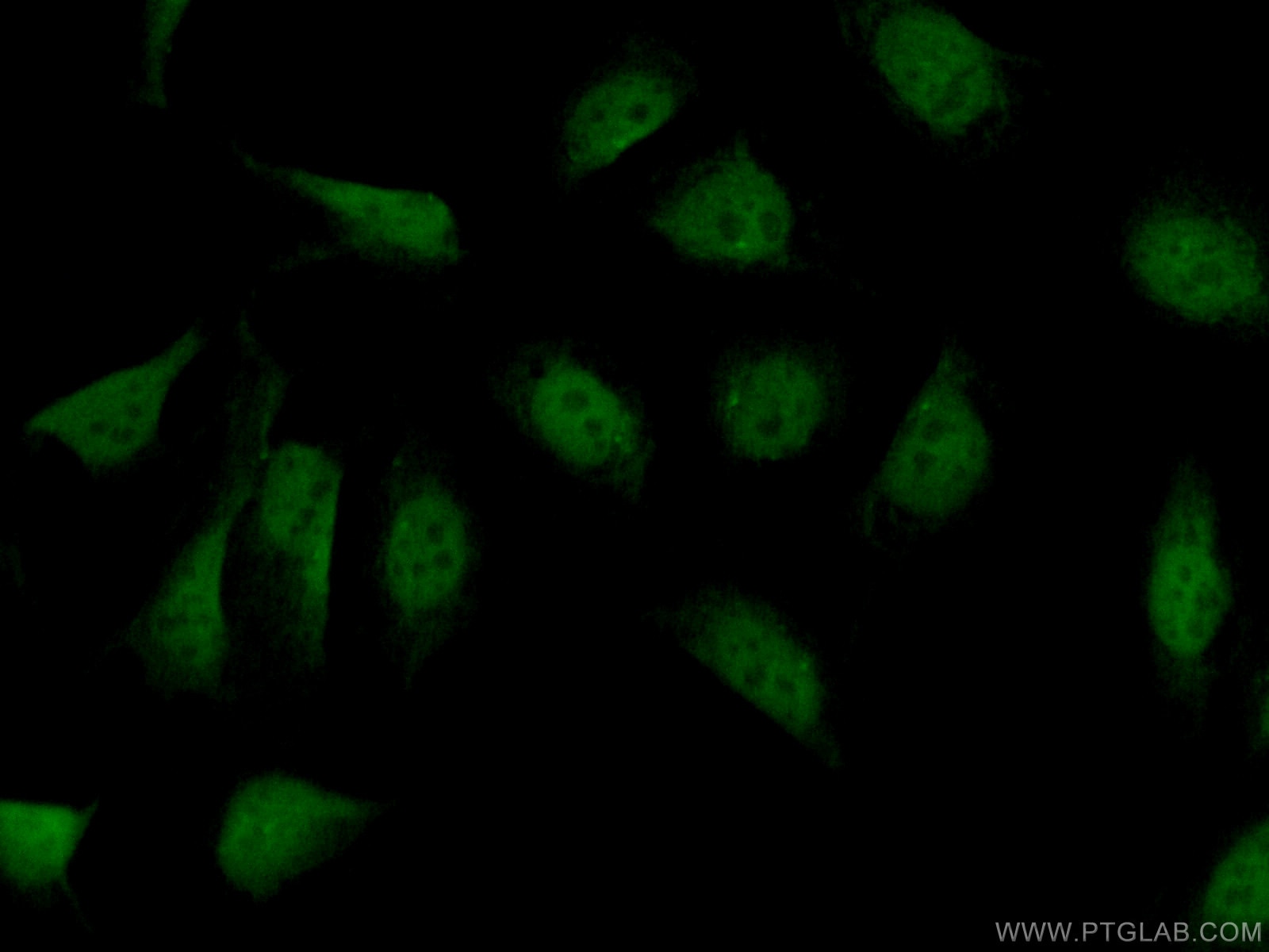 Immunofluorescence (IF) / fluorescent staining of U2OS cells using PARP2 Polyclonal antibody (55149-1-AP)