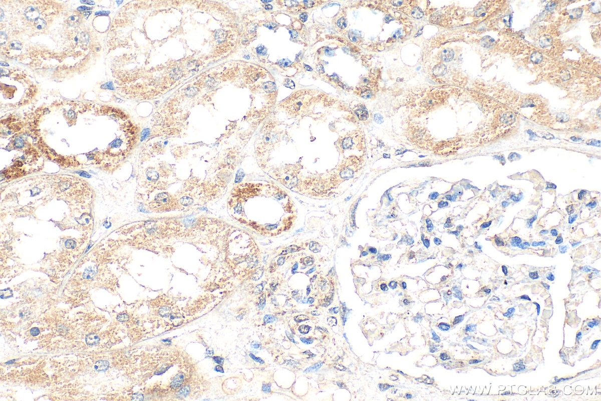 Immunohistochemistry (IHC) staining of human kidney tissue using PARP2 Polyclonal antibody (55149-1-AP)