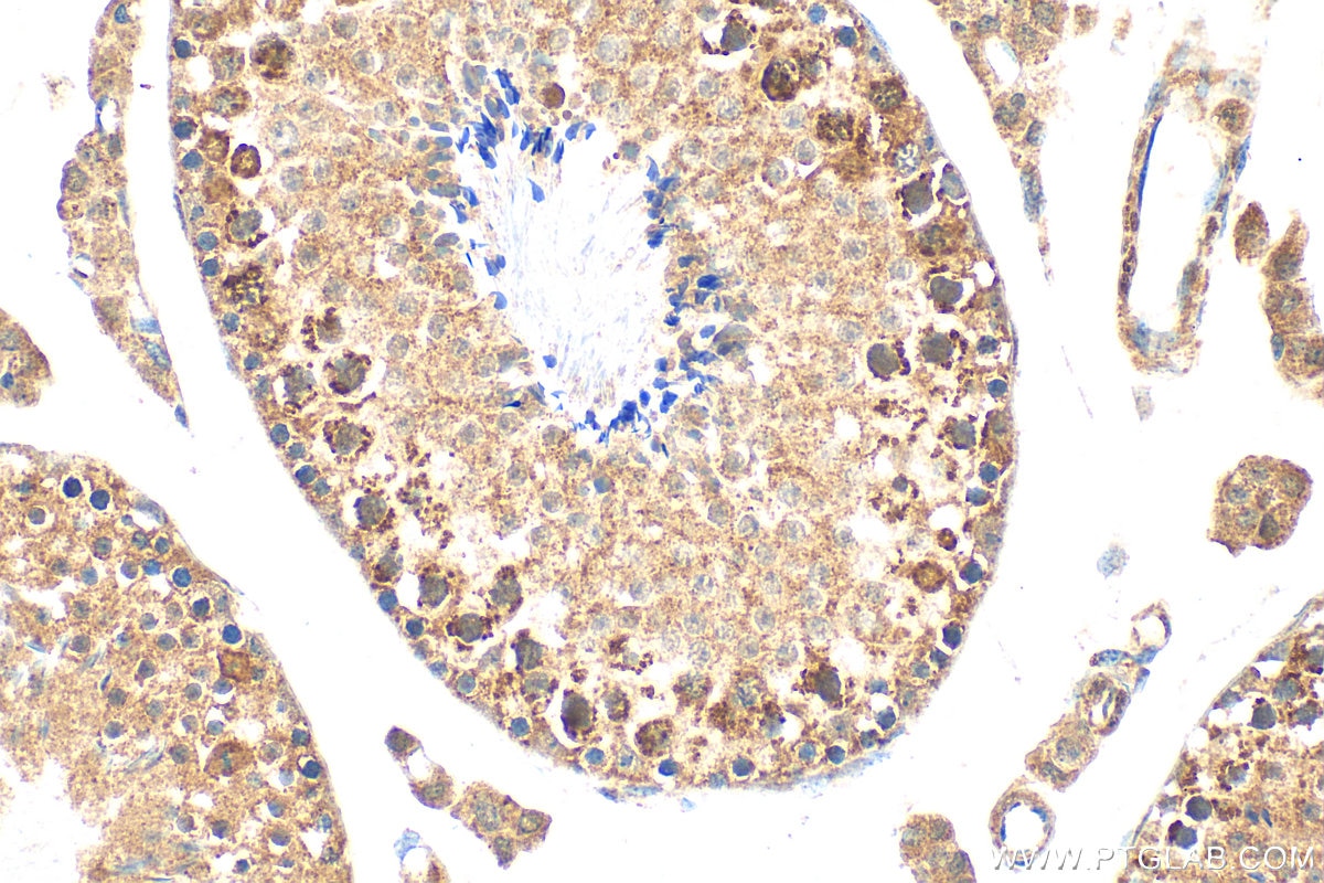 Immunohistochemistry (IHC) staining of mouse testis tissue using PARP2 Polyclonal antibody (55149-1-AP)