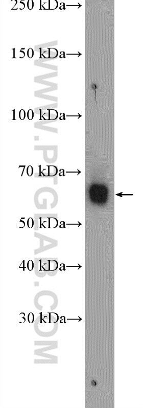 Western Blot (WB) analysis of rat heart tissue using PARP3 Polyclonal antibody (11289-1-AP)