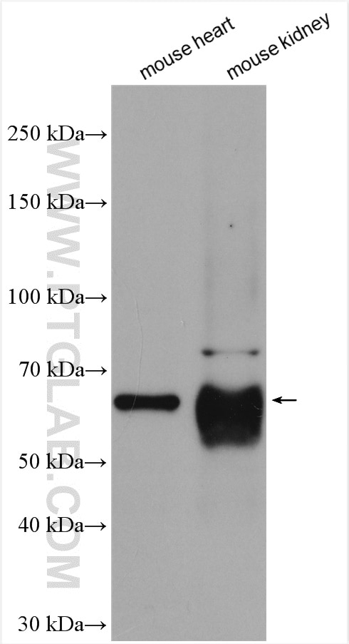 Western Blot (WB) analysis of various lysates using PARP3 Polyclonal antibody (11289-1-AP)