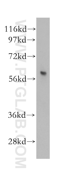 Western Blot (WB) analysis of human heart tissue using PARP3 Polyclonal antibody (11289-1-AP)