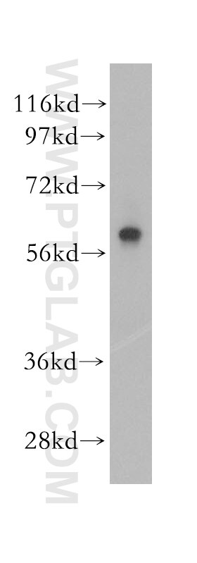 Western Blot (WB) analysis of human kidney tissue using PARP3 Polyclonal antibody (11289-1-AP)