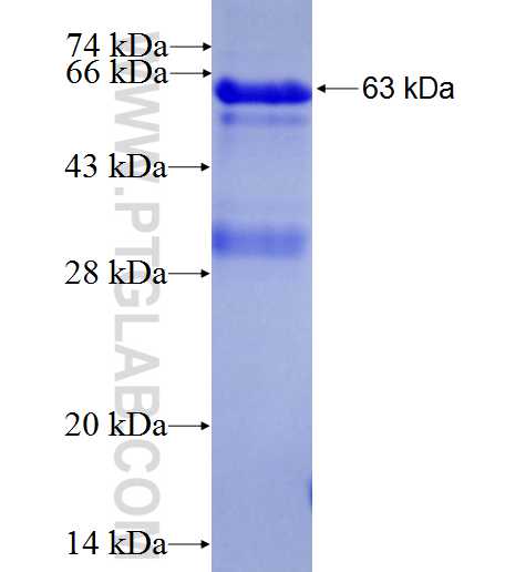 PARP3 fusion protein Ag1844 SDS-PAGE