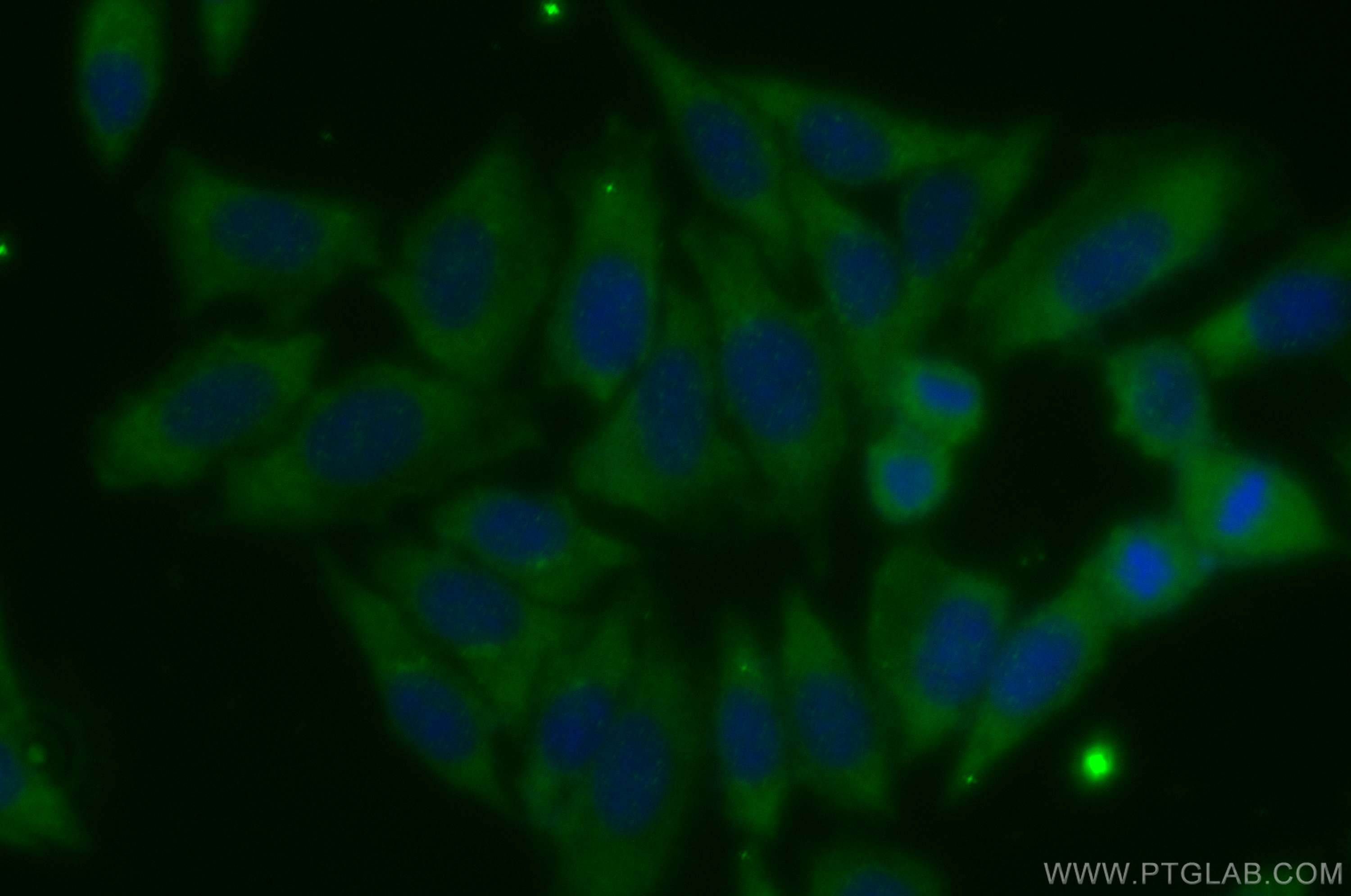 Immunofluorescence (IF) / fluorescent staining of HepG2 cells using PARP4 Polyclonal antibody (19775-1-AP)