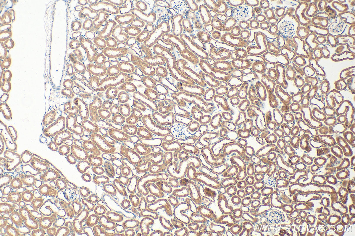 Immunohistochemistry (IHC) staining of mouse kidney tissue using PARP4 Polyclonal antibody (19775-1-AP)
