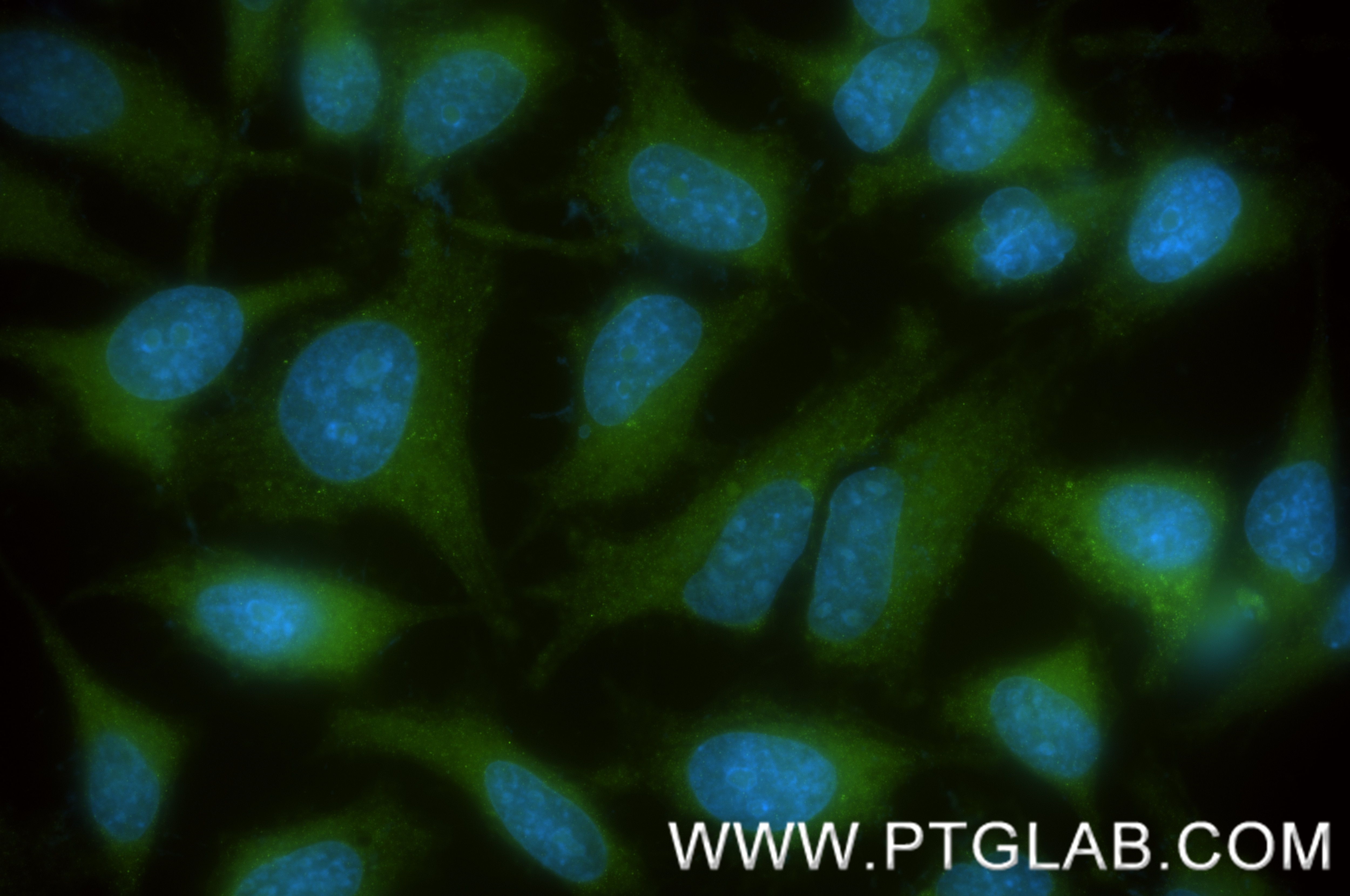 Immunofluorescence (IF) / fluorescent staining of HeLa cells using PARP4 Recombinant antibody (84001-1-RR)
