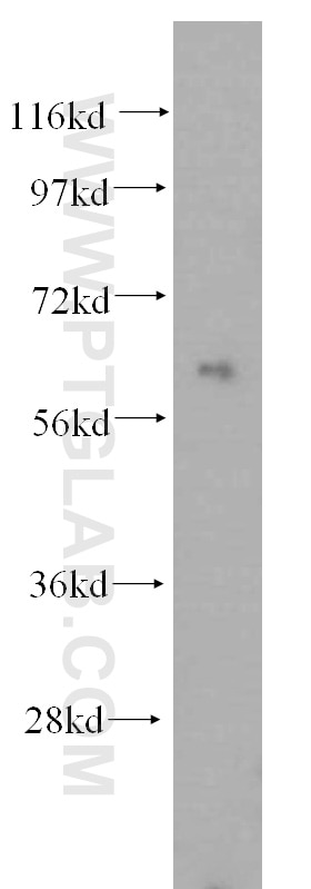 Western Blot (WB) analysis of Jurkat cells using PARP6 Polyclonal antibody (16945-1-AP)