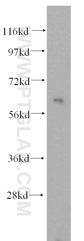 WB analysis of Jurkat using 16945-1-AP