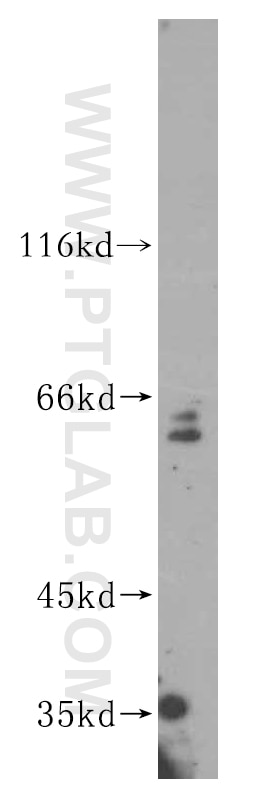 Western Blot (WB) analysis of HepG2 cells using PARP6 Polyclonal antibody (16945-1-AP)