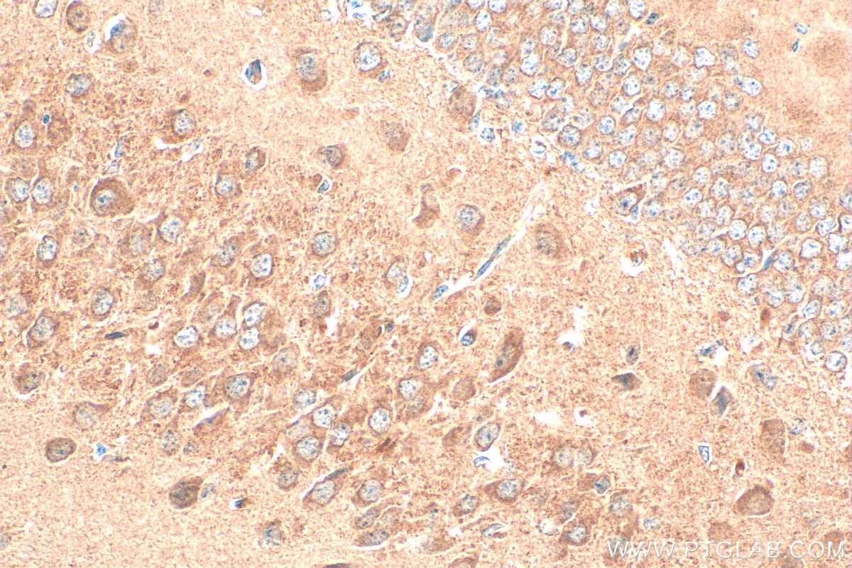 Immunohistochemistry (IHC) staining of mouse brain tissue using PARP9 Polyclonal antibody (17535-1-AP)