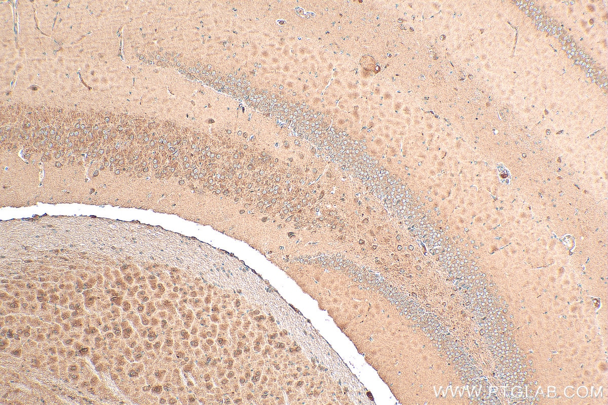 Immunohistochemistry (IHC) staining of mouse brain tissue using PARP9 Polyclonal antibody (17535-1-AP)