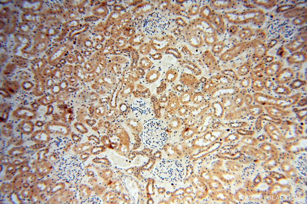 Immunohistochemistry (IHC) staining of human kidney tissue using PARP9 Polyclonal antibody (17535-1-AP)