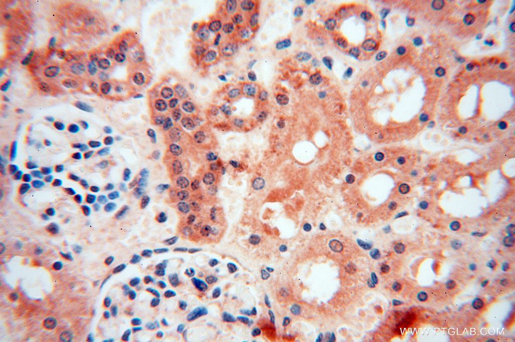 Immunohistochemistry (IHC) staining of human kidney tissue using PARP9 Polyclonal antibody (17535-1-AP)