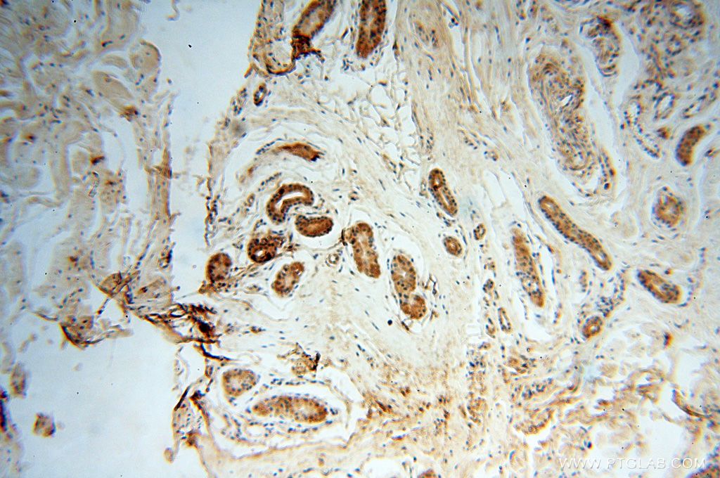 Immunohistochemistry (IHC) staining of human skin tissue using PARP9 Polyclonal antibody (17535-1-AP)