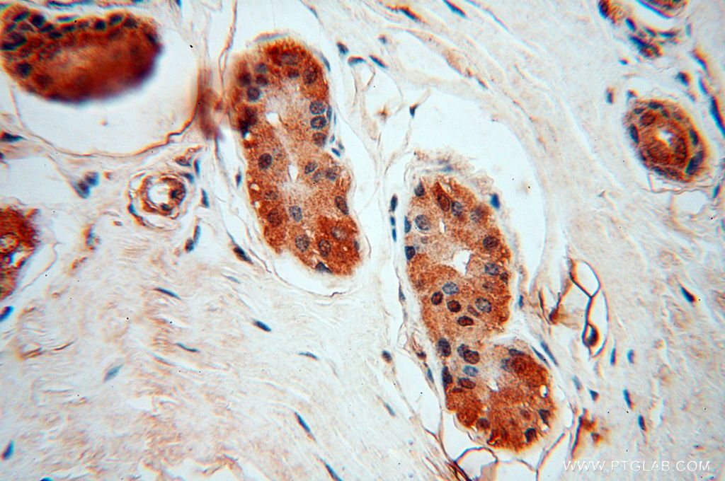 IHC staining of human skin using 17535-1-AP