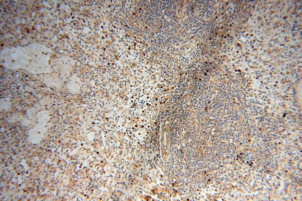 IHC staining of human spleen using 17535-1-AP