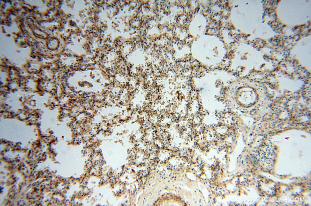 Immunohistochemistry (IHC) staining of human lung tissue using PARP9 Polyclonal antibody (17535-1-AP)