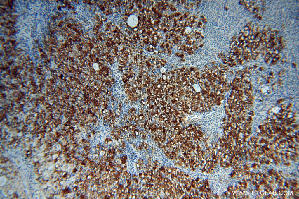 Immunohistochemistry (IHC) staining of human ovary tissue using PARP9 Polyclonal antibody (17535-1-AP)