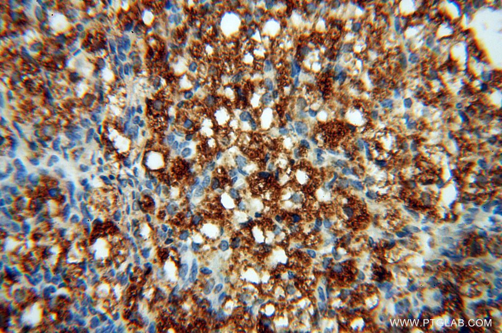 Immunohistochemistry (IHC) staining of human ovary tissue using PARP9 Polyclonal antibody (17535-1-AP)