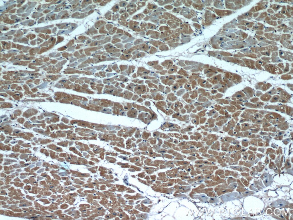 Immunohistochemistry (IHC) staining of human heart tissue using PARP9 Polyclonal antibody (17535-1-AP)