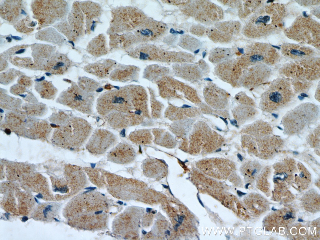 Immunohistochemistry (IHC) staining of human heart tissue using PARP9 Polyclonal antibody (17535-1-AP)