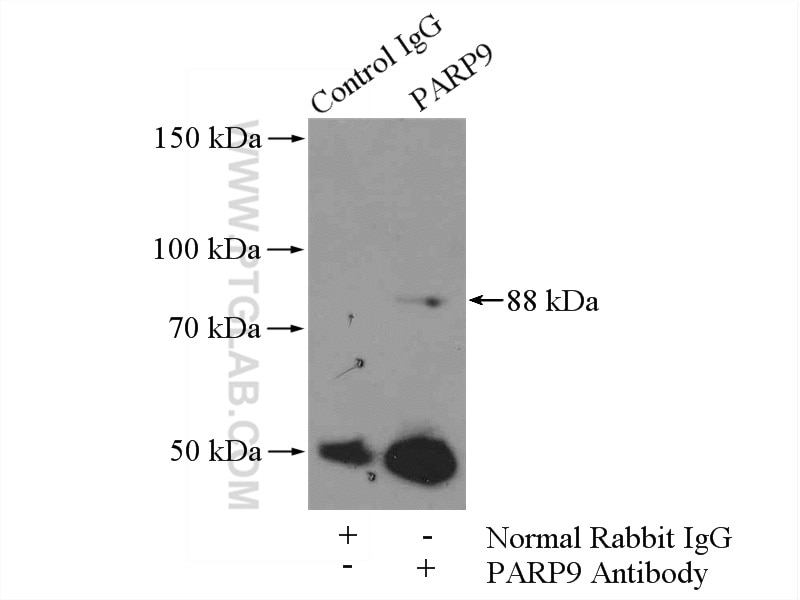 Immunoprecipitation (IP) experiment of MCF-7 cells using PARP9 Polyclonal antibody (17535-1-AP)